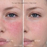 Niacinamide Cream