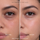 Vitamin C Eye Gel
