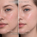 Vitamin C Facial Serum